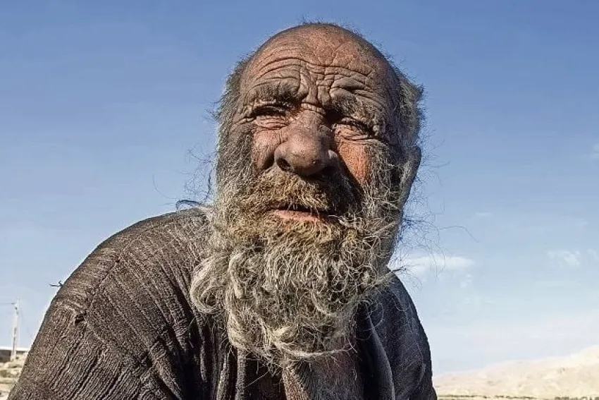 Murió “el hombre más sucio del mundo”: por qué estuvo medio siglo sin bañarse￼