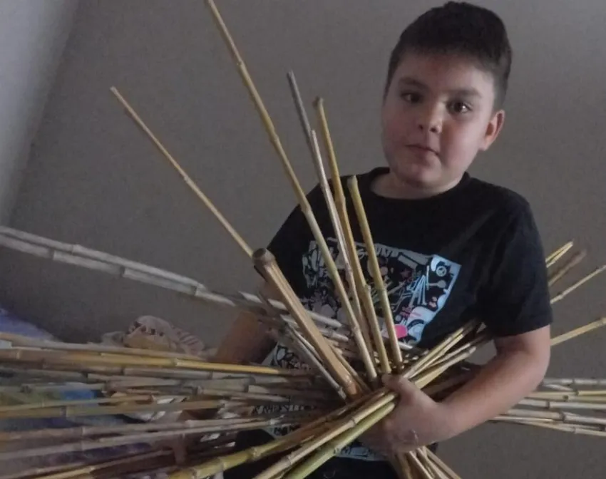 Niño correntino padece una extraña enfermedad y debe someterse a una costosa operación