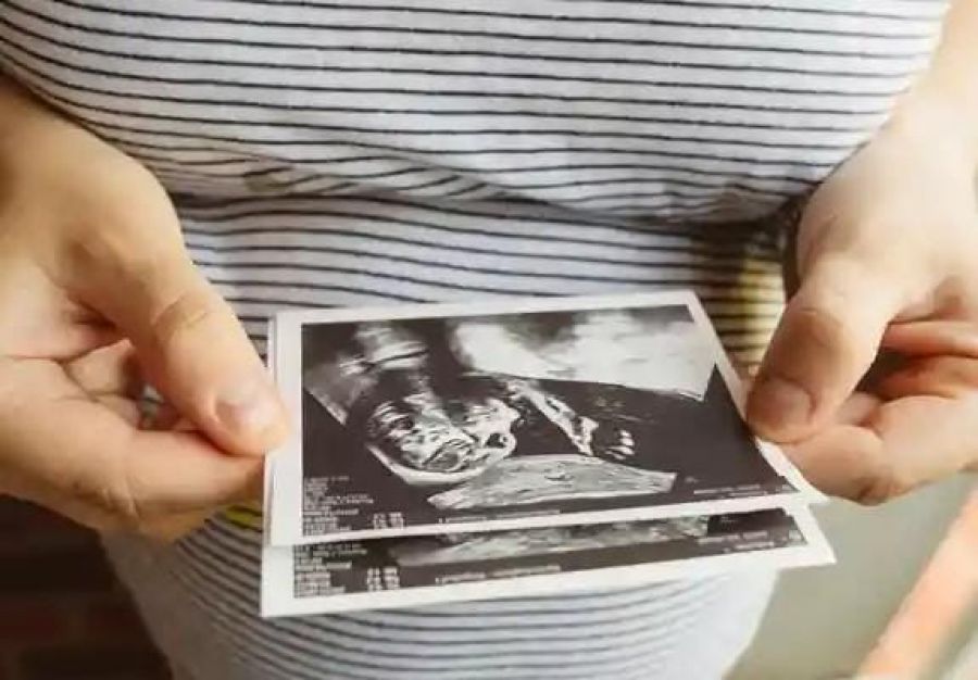 Mujer nacida con dos úteros está embarazada en ambos